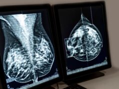 Novartis recibe aprobación de la Comisión Europea para Kisqali en cáncer de mama HR+/HER2- con alto riesgo de recaída