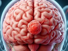 Astuce Spain llama a la equidad y la innovación en tratamientos de tumores cerebrales