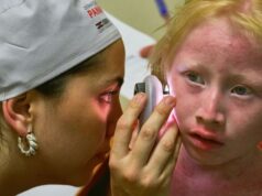 Personas con albinismo en Panamá reciben atención dermatológica gracias a Isdin