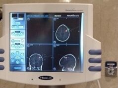 Neuronavegación: tecnología clave para tumores cerebrales y estenosis lumbar