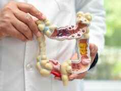 La detección precoz mejora el pronóstico del cáncer de colon