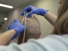El hospital público Universitario 12 de Octubre de la Comunidad de Madrid participa en un ensayo clínico internacional EF-41/KEYNOTE D58 en glioblastoma recién diagnosticado