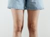 Varices después del verano: las señales que aconsejan una valoración médica