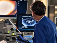 Una técnica de radiofrecuencia abre nuevas opciones para tratar los insulinomas